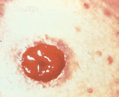 Eine Nahaufnahme der Haut einer Person