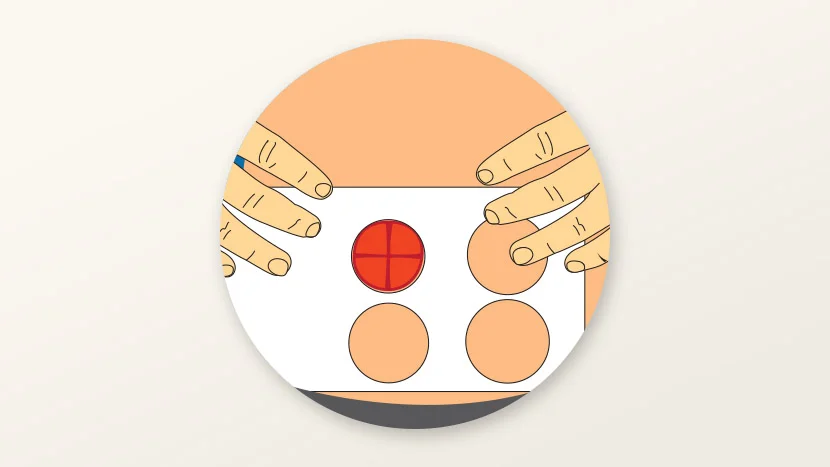 Ilustrácia merania stómie