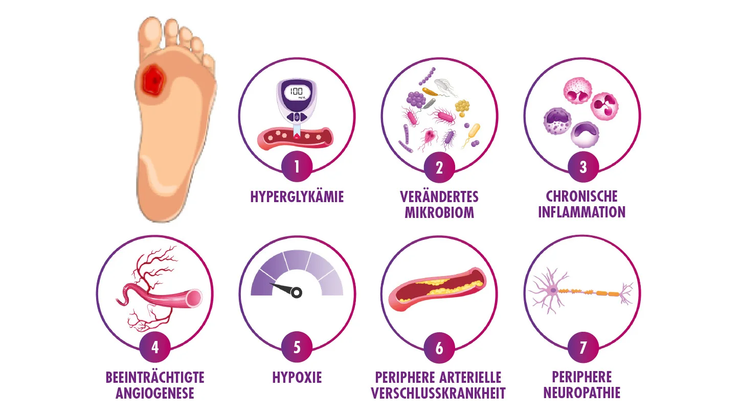 Grafik, die mit verschiedenen Abbildungen die Risikofaktoren von DFU darstellt 