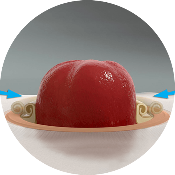 a close-up of a mouldable baseplate