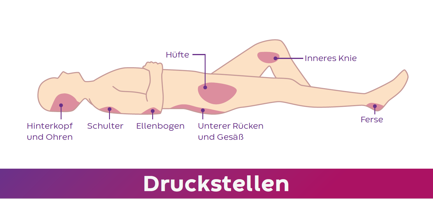 Gef&auml;hrdete K&ouml;rperstellen f&uuml;r Druckstellen